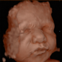 Womb With a View Photo